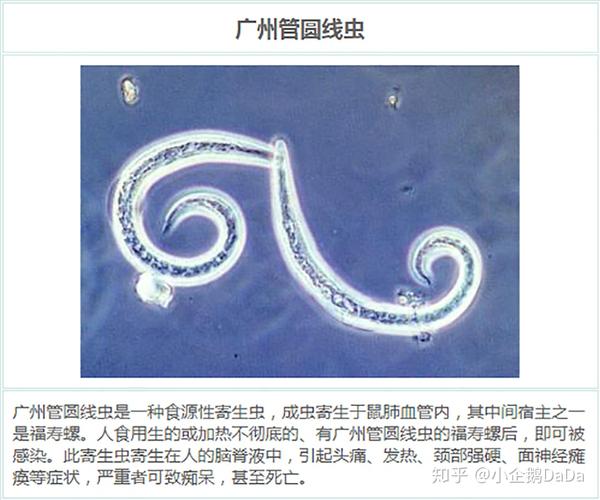 2025新澳门黄大仙和自来水中含活体虫与自来水中含活体虫吗